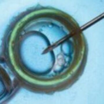 Ημερίδα με θέμα «Πρόγνωση-Πρόληψη-Ενημέρωση για τη Γονιμότητα»