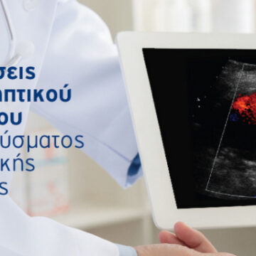 Δωρεάν προληπτικός έλεγχος για το ανεύρυσμα κοιλιακής αορτής