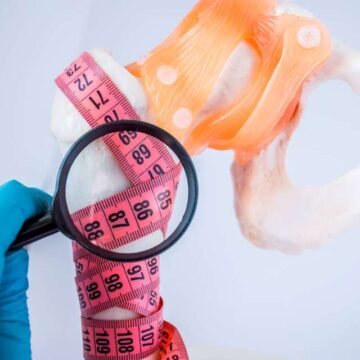 Δωρεάν προληπτικοί έλεγχοι για την οστεοπόρωση και τη χρόνια φλεβική νόσο