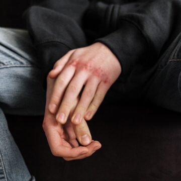 Ενημερωτική εκδήλωση για τις εξαρτήσεις και τη βία