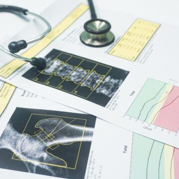 PALLHNH_EXETASEIS OSTEOPOROSHS Πρόγραμμα δωρεάν προληπτικών εξετάσεων οστεοπόρωσης