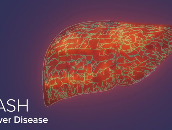 Δωρεάν έλεγχος για τη νόσο MASH